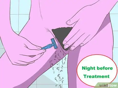 Image titled Remove Vaginal Hair Step 37