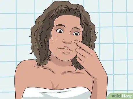 Image titled Get Rid of Acne Redness Step 24