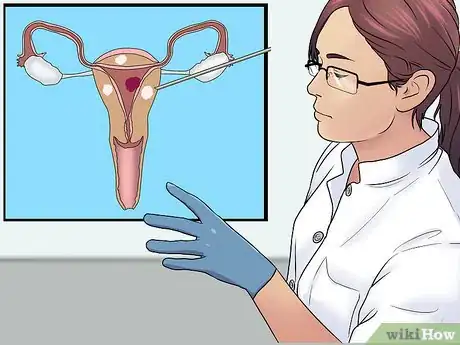 Image titled Get Rid of Uterine Fibroid Pain Step 18