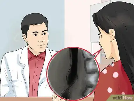 Image titled Know if You Have Esophagitis Step 15