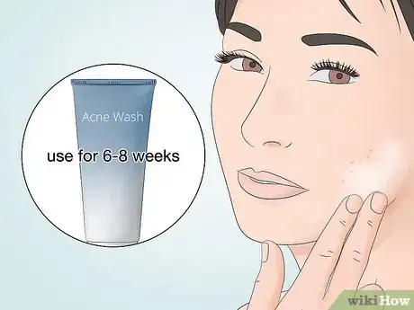 Image titled Wash an Acne Prone Face Step 15