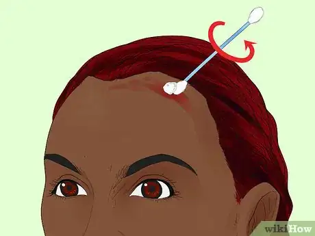 Image titled Remove Hair Dye from Your Scalp Step 8