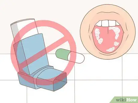 Image titled Prevent Oral Thrush Step 12