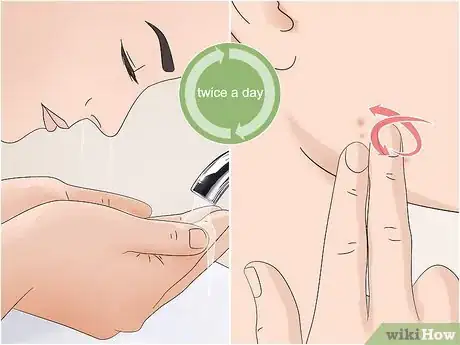 Image titled Use Argan Oil for Acne Step 7