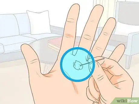 Image titled Treat a Blood Blister Step 12