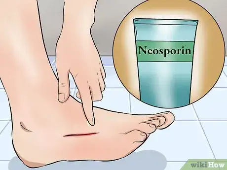 Image titled Care for a Cut Step 4