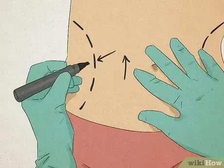 Image titled Become a Specialist Physician Step 7