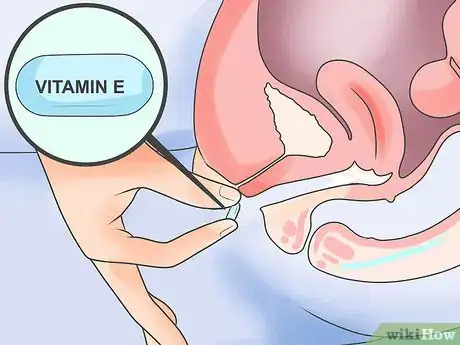 Image titled Treat Vaginal Dryness During Menopause Step 5
