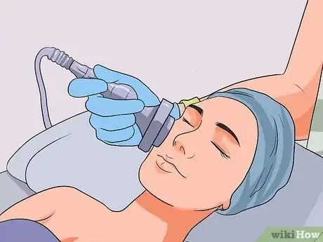 Image titled Get Rid of Acne Blemishes Step 15