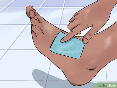 Image titled Care for a Cut Step 2