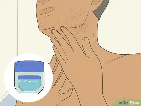 Image titled Get Rid of Razor Burn Fast Step 14