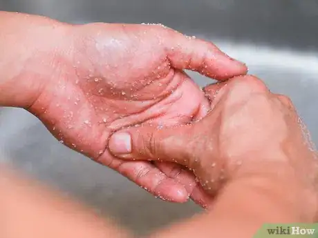Image titled Get Super Glue off of Your Hands with Salt Step 5