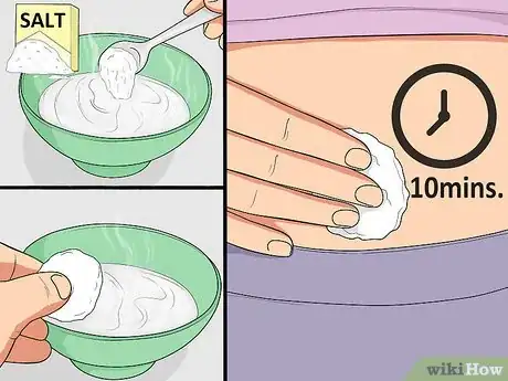 Image titled Treat an Irritated Belly Button Piercing Step 11