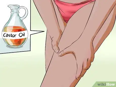 Image titled Get Rid of a Rash Between Your Legs Step 8