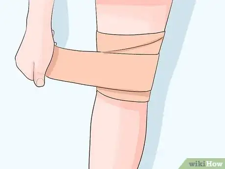 Image titled Do Skin Icing Step 12