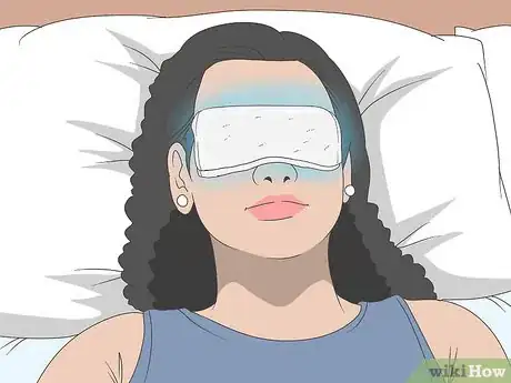 Image titled Treat Eye Sunburn Step 8
