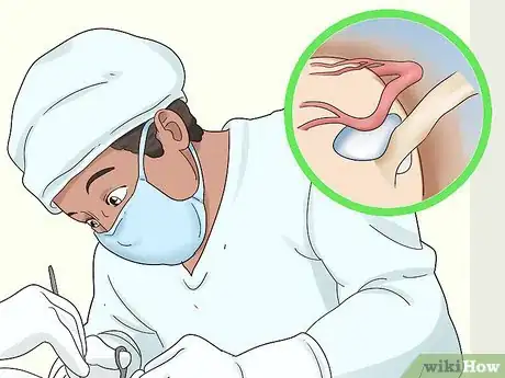 Image titled Stop Muscle Twitches Step 9