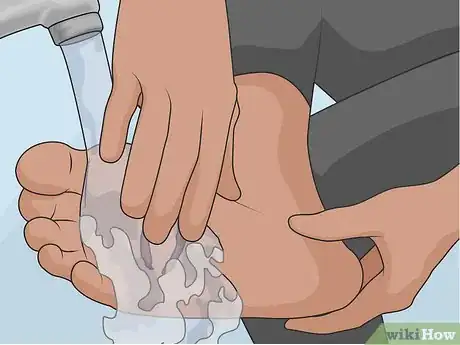 Image titled Treat a Foot Wound Step 11