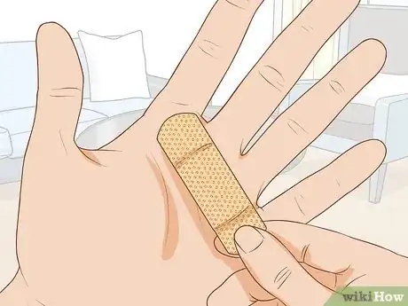 Image titled Treat a Blood Blister Step 15