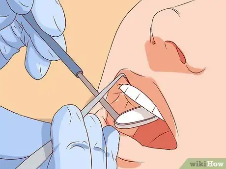 Image titled Fix a Loose Tooth Step 1