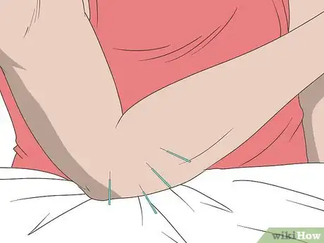 Image titled Treat Rheumatoid Arthritis in the Elbow Step 7