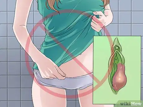Image titled Treat Vaginal Cysts Step 11