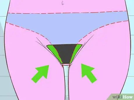 Image titled Remove Vaginal Hair Step 1