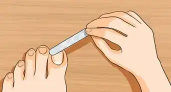 Get Rid of Yellow Toenails