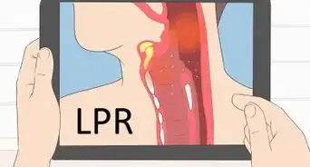 Diagnose Laryngopharyngeal Reflux
