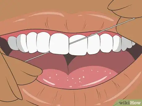 Image titled Avoid Hurting Your Gums Step 12