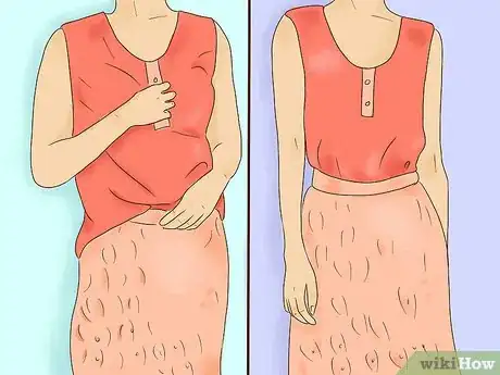 Image titled Wear a Lace Skirt Step 6