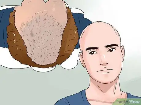 Image titled Choose the Right Hair Loss Option Step 13