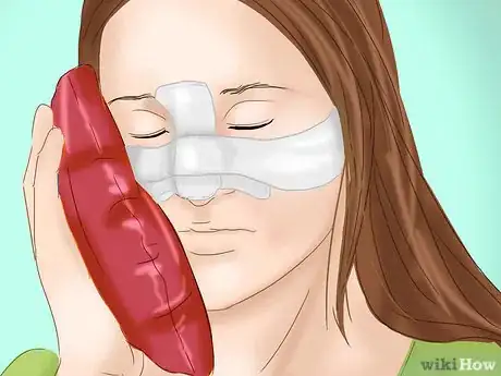 Image titled Prevent Bruising After Plastic Surgery Step 10