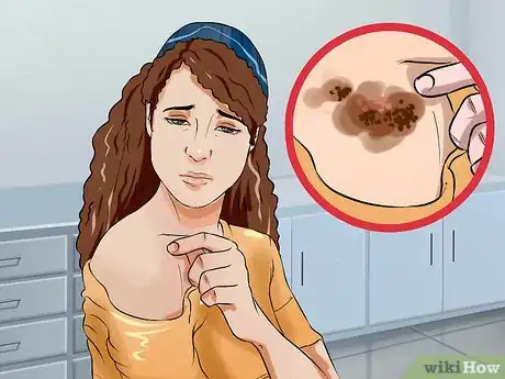 Image titled Cut Health Costs Step 14