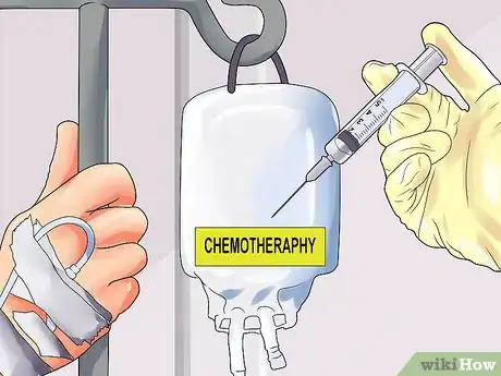 Image titled Remove a Thymoma Step 16