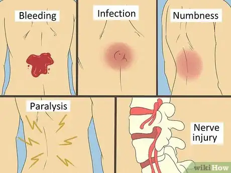 Image titled Treat Chronic Back Pain with Radio Waves Step 8