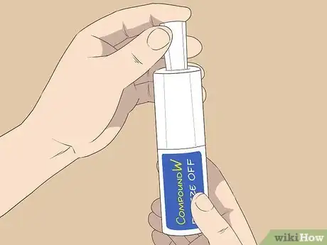 Image titled Freeze Plantar Warts Step 4