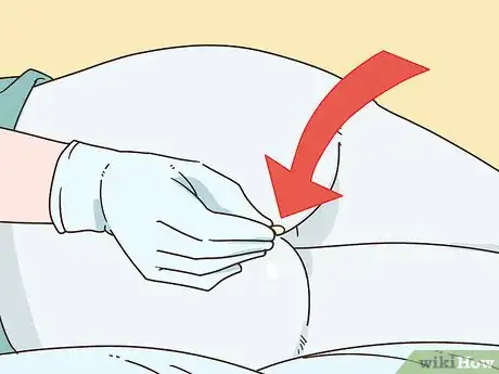 Image titled Treat Crohn's with Corticosteroids Step 3