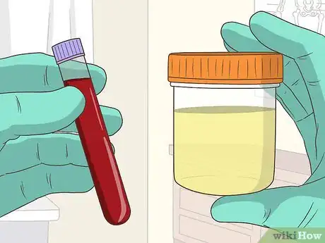 Image titled Diagnose Castleman Disease Step 6