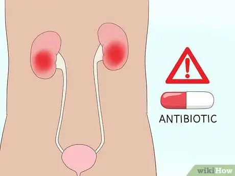 Image titled Bring Down High Creatinine Levels Step 15