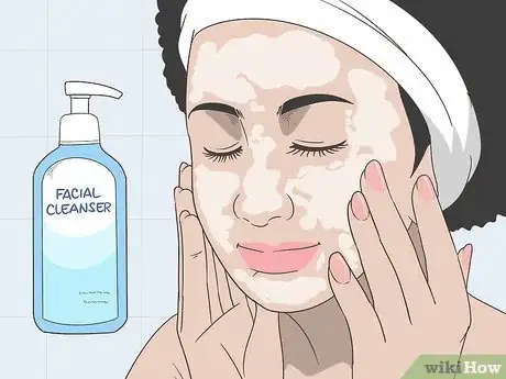 Image titled How to Treat Rosacea Can Herbal Remedies Help Step 13