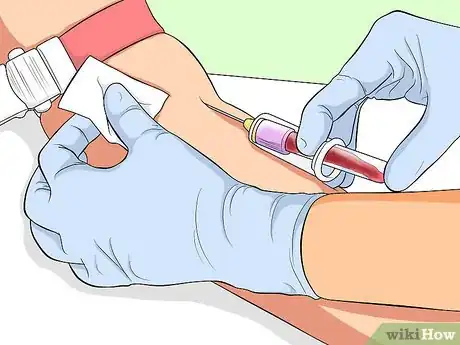 Image titled Treat Polycythemia Vera Step 2
