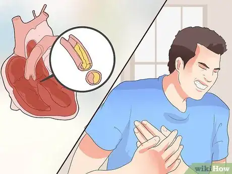 Image titled Spot Symptoms of Coronary Heart Disease Step 5