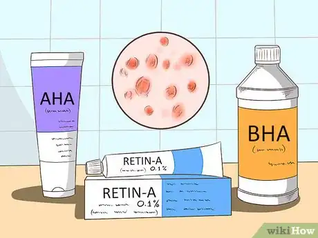 Image titled Get Rid of Acne Scars Step 2