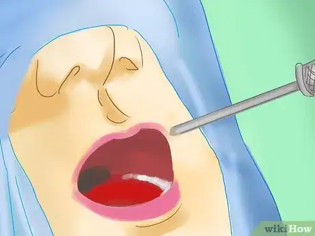 Image titled Stop Snoring Using Medical Devices Step 4