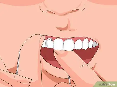 Image titled Avoid Tooth Decay Step 9