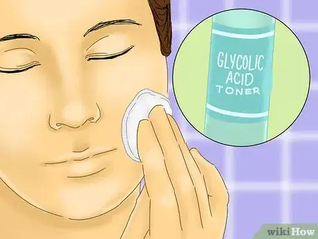 Image titled Get Rid of Blackheads and Whiteheads Using Commercial Products Step 10