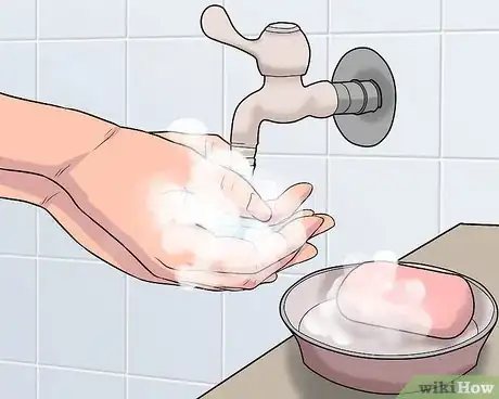 Image titled Use a Band Aid Step 8