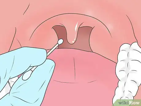 Image titled Diagnose Nocturnal Asthma Step 10
