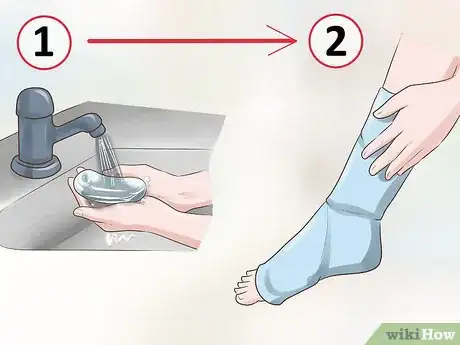 Image titled Treat a Growth Plate Fracture Step 8